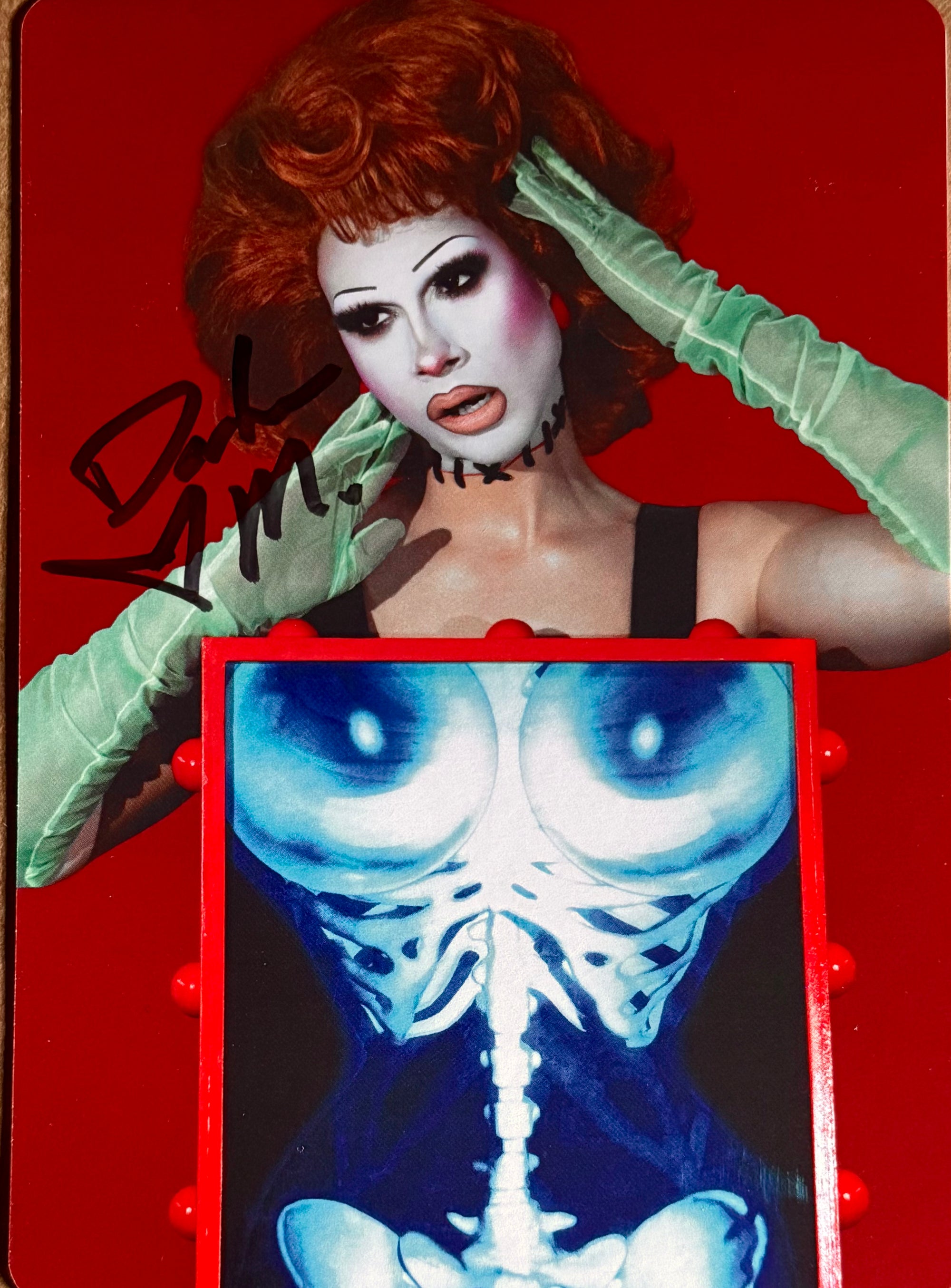X-Ray Jumbo Double-Sided Signed Postcard